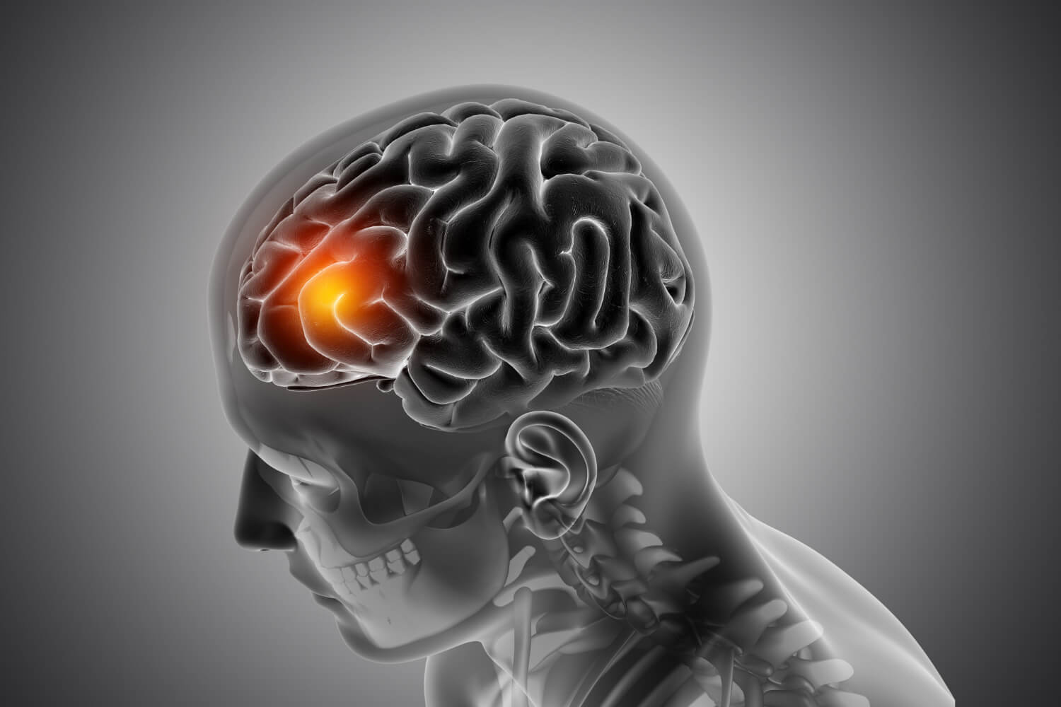 Santa Monica Brain Injury Attorney - Symptoms and Severity of Brain Injuries