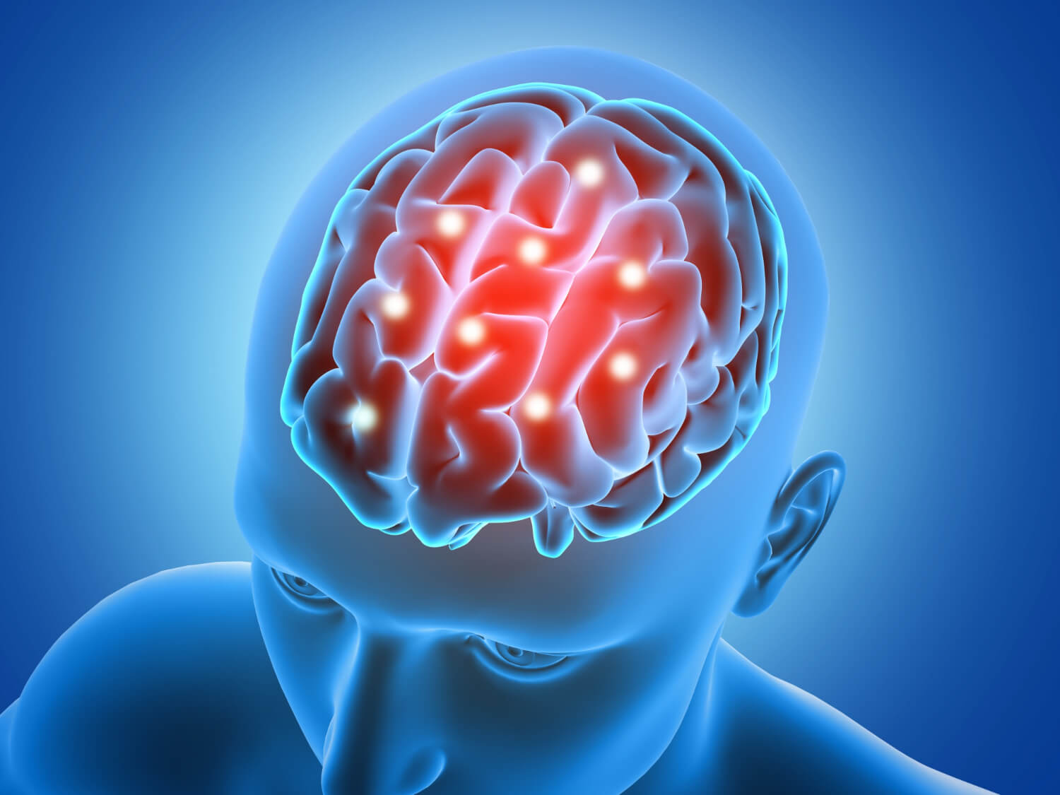Santa Monica Brain Injury Lawyer - Time Limits for Filing a TBI Claim in California